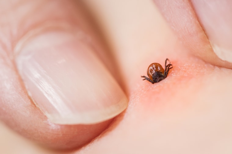 What Does A Tick Bite Look Like